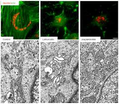 It acts to process and package the macromolecules such as proteins and lipids that are synthesized by the cell. Cytoskeleton And Golgi Apparatus Interactions A Two Way Road Of Funct Chc