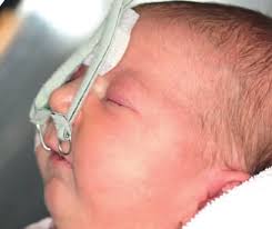 Elterninformation Robin-Sequenz