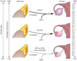 Endocrine Autoimmune Diseases And Female Infertility Nature Reviews Endocrinology