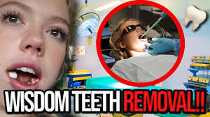 GETTING MY WISDOM TEETH REMOVED!! Funny Reactions