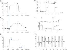 Ataxia with oculomotor apraxia type 2 (aoa2) is a rare condition that affects muscle control and coordination. Comparing Ataxias With Oculomotor Apraxia A Multimodal Study Of Aoa1 Aoa2 And At Focusing On Video Oculography And Alpha Fetoprotein Scientific Reports