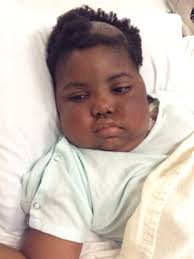 Mitch Albom shares Chika's story: A fight to cure the incurable