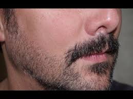 Let me tell you it is not easy to remove facial hair naturally. Moustache Hair Transplant Best Facial Hair Restoration Punjab