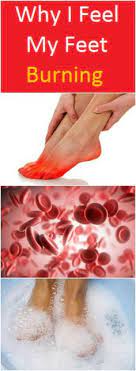 The Burning Of Feet Is A Burning Sensation That Can Occur More Localized On The Soles Of The Feet And Be Accompanie Natural Remedies Natural Cures Healthy Tips
