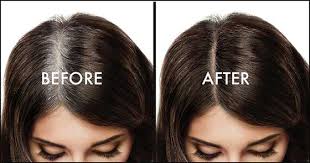 To turn grey or white hair back to black naturally without using dyes.just mix 2 spoons of amla powder that is goose berry powder with 8 spoons of indigo powder with warm water to make a smooth paste.(ratio has to be 2:8 only). Why Hair Get White Get Rid Of White Hair Top To Find