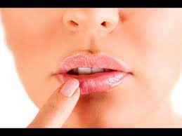 Fuegos O Herpes Labial Por Que Aparecen Y Como Curarlos Noticias Caracol Youtube