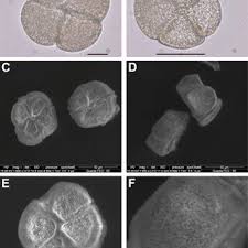 Image result for Dactyladenia gilletii