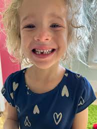 Baby girl's first tooth. Gone.