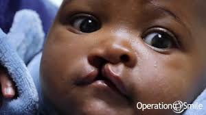 Another successful surgical programme at Rob Ferreira Hospital in Mpumalanga