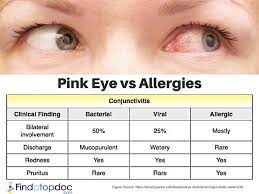 Your Eyes Are Incredibly Sensitive To Irritants And Microbes While Red Eyes Can Come From Not Getting Enough Sleep Or Pink Eyes Sinusitis Diseases Of The Eye