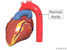 An aneurysm is a weak point in a blood vessel wall, most commonly in an artery. Https Encrypted Tbn0 Gstatic Com Images Q Tbn And9gcqr12yzagjj4n82dglasdxhm9vk66wdwr5yuw Usqp Cau