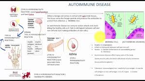 In my reading of the literature, there are several intertwined factors that may affect risk of autoimmune disease Introduction To Autoimmune Disease Youtube