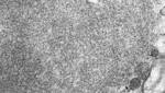  Rabies: CDC develops new rapid test, Could lead to fewer shots