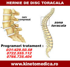 Rareori, o hernie de disc cervicala poate apasa pe maduva si cauza si amorteli ale picioarelor. Hernie De Disc Toracala Recuperare Cabinet Kinetoterapie Fizioterapie Bucuresti Sector 4 5 6 3 2 1 Tratament Hernie De Disc Toracala