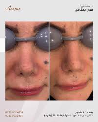 Anwar Issa Hasan (@dr_anwar_isaa) · Baghdad