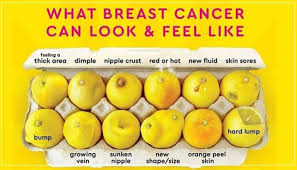 Breast cancer causes, symptoms & signs. 5 Symptoms Of Breast Cancer You Should Look Out For Htv