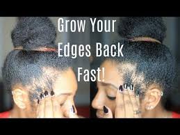 Hair Grow Out Your Edges Amp Bald Spots Fast Video Black Hair Information Grow Black Hair Natural Hair Styles Black Hair Growth