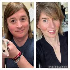 Plastic Surgery Results of Face : r/PlasticSurgery