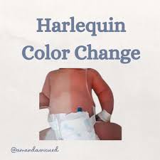 Image result for Harlequin Color Change