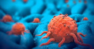 Cancer is the uncontrolled growth of abnormal cells anywhere in a body.; How Cancer Cells Find Ways To Resist Treatment Ctca
