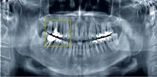 She was a 7th generation member of hop club and a 2nd generation member, number 11, o. Morita Uk Morita Uk Twitter