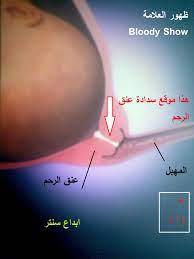 السدادة المخاطية هي التي تغلق عنق الرحم وتمنع نزول الطفل، وعند أقتراب موعد الولادة يفقد الرحم هذه السدادة وتنزل على شكل إفرازات مهبلية، وبعد ذلك. Ù„Ø£ÙˆÙ„ Ù…Ø±Ø© Ø´Ø±Ø­ Ø¨Ø§Ù„ØµÙˆØ± Ø®Ø±ÙˆØ¬ Ø³Ø¯Ø§Ø¯ Ø¹Ù†Ù‚ Ø§Ù„Ø±Ø­Ù… ØºÙŠØ± Ù…Ù†Ù‚ÙˆÙ„ ÙƒÙŠÙÙ‡ ØªØ®ÙÙŠÙ Ø¢Ù„Ø§Ù… Ø§Ù„Ø·Ù„Ù‚ Ø§Ù„ÙƒØ§Ø°Ø¨ Ø¹Ø§Ù„Ù… Ø­ÙˆØ§Ø¡