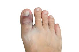 Triad Foot Ankle Center