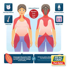 Image result for Polymyalgia Rheumatica