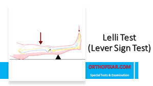 Image result for Lever Test