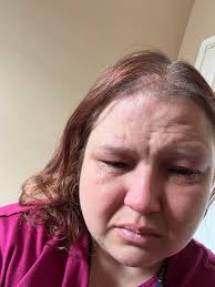 Has anyone fallen crashing tumbling from a tree?