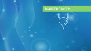 Although use of chemotherapy may improve survival and may rarely put someone into a temporary remission the disease usually returns or more often does not go away and eventually progresses and the patient will eventually succumb to it. Treatment Of Stage Iv Metastatic Or Recurrent Colon Cancer Cancerconnect