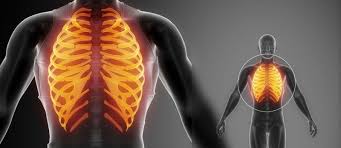 Cause of rib cage pain varies from fracture to lung cancer. The Link Between Back Pain Rib Pain Dr Stefano Sinicropi