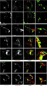 Evaluation Of Nanoparticles As Endocytic Tracers In Cellular Microbiology Nanoscale Rsc Publishing Doi 10 1039 C3nr01550e