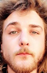 Nathan Cortes in court for assault, harassing and wilful damage