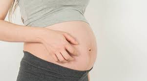 How to treat skin conditions during pregnancy, according to a ...