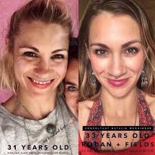 Natural skincare alternatives to RF treatments