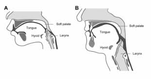 Image result for Swallowing