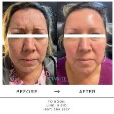 Onsite Wellness Now, 550 E Chapman Ave, Ste E, Orange, CA 92866, US