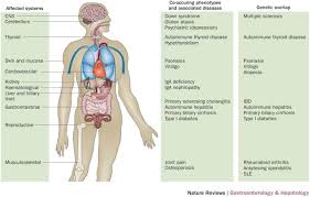 Coeliac Disease And Autoimmune Disease Genetic Overlap And Screening Nature Reviews Gastroenterology Hepatology