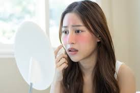 7 Ciri-Ciri Skin Barrier Rusak yang Perlu Diketahui