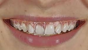 What elements are necessary for a beautiful smile that meets medical  standards?