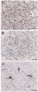 Lumor terminated his contract after failing to secure a place in the … Immunohistochemical Stainings Of Lumor Sections A Iunior 18 Showing Download Scientific Diagram