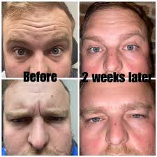 Bluegrass Weight Loss and Aesthetics