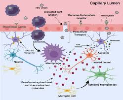 See what martin rutter (deftydowwwg) has discovered on pinterest, the world's biggest collection of ideas. Potential Pharmacological Approaches For The Treatment Of Hiv 1 Associated Neurocognitive Disorders Fluids And Barriers Of The Cns Full Text