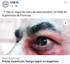 El hongo negro afecta el cerebro o los pulmones, por lo general, en personas que tienen un sistema inmunológico debilitado. Zxwwrcvordiylm
