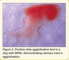 Management Of Immune Mediated Hemolytic Anemia