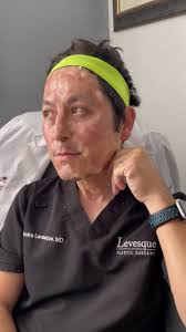 Hello to smoother glowing skin. Watch Dr. Levesque combine CO2 lift  carboxytherapy with SkinPen microneedling for the ultimate skin  rejuvenation treatment. This powerful duo helps reduce redness, ...