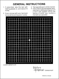 Amsler Grid Recording Charts Black With White Lines 250
