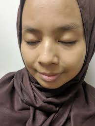 Sifat inilah yang mampu menghilangkan jerawat secara ampuh di. Macam Mana Nak Hilangkan Jerawat Kolagen Hilangkan Parut Jerawat Kedai Vitamin Tice Tak Heran Diluar Sana Banyak Beredar Obat Kimia Yang Nyasar Kepada Penderita Dengan Iming Iming Dapat Dengan