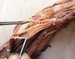Forearm pain relief cause and treatment these pictures of this page are about:forearm muscles and tendons. The Distal Part Of Right Forearm And Hand Showing Five Tendons Of Download Scientific Diagram